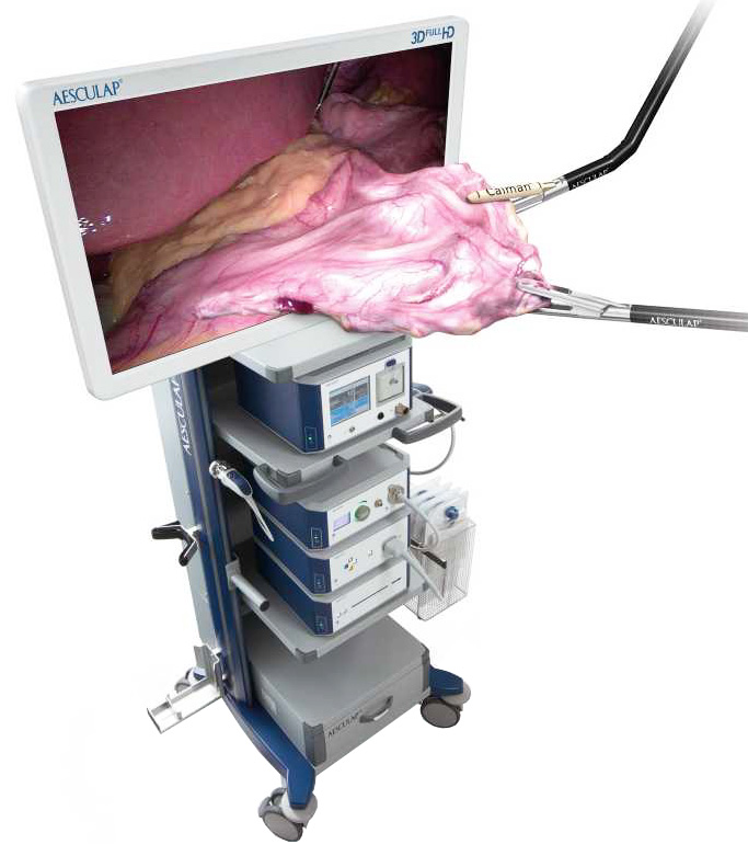 3d Laparoscopic System, Einstein Vision 3d Laparoscopic System